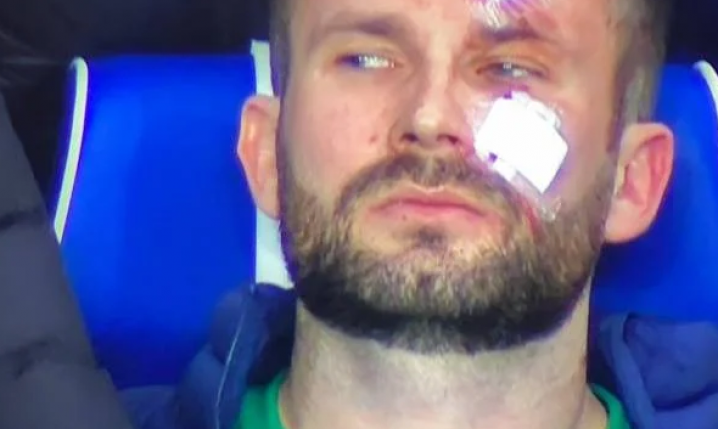 TWARZ bramkarza Slavii po brutalnym ataku piłkarza Rangers